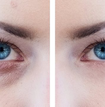 how-to-remove-bags-from-under-your-eyes