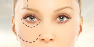 Eyelid Surgery