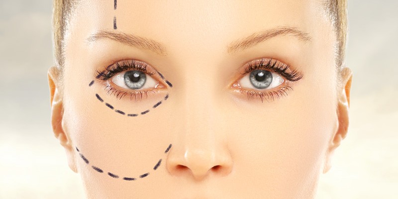 All You Need to Know About Eyelid Surgery (Cost, Method, Side Effects)