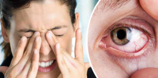 Dry Eyes Treatment