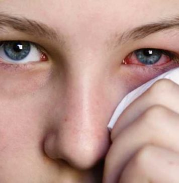 Swollen Eyelid