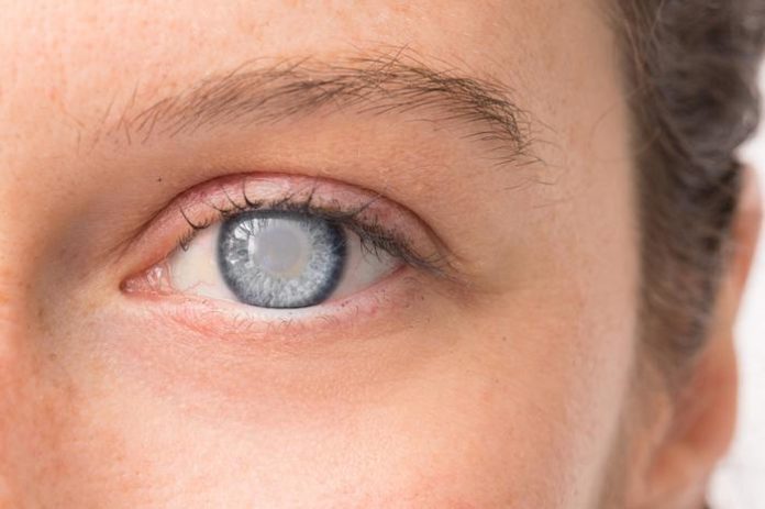 most-common-eye-problems-and-their-treatment