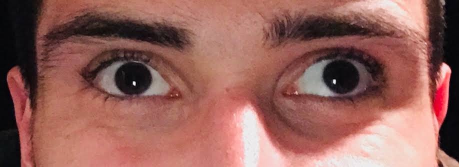 Eye Problem