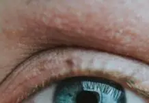 wrinkles and eye cream